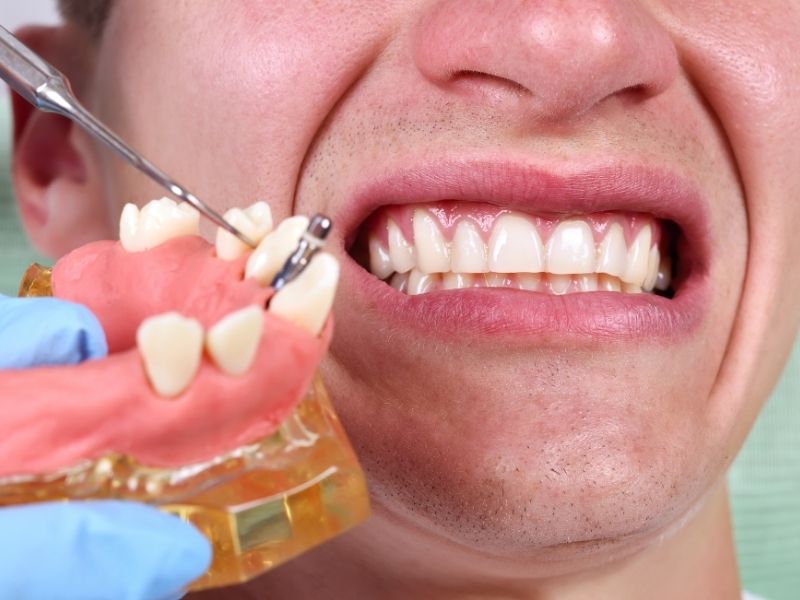 man getting an oral implant