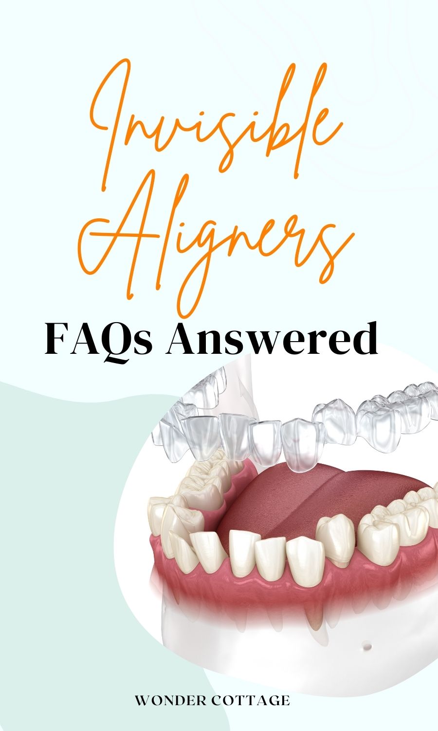 Invisible Aligners; FAQs Answered