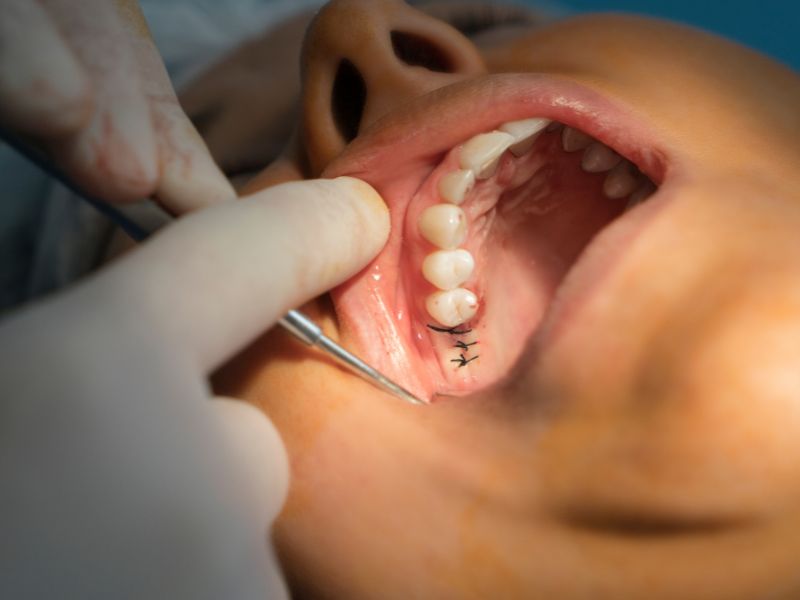 Marketing Tips For 2023 For Your Dental Surgery