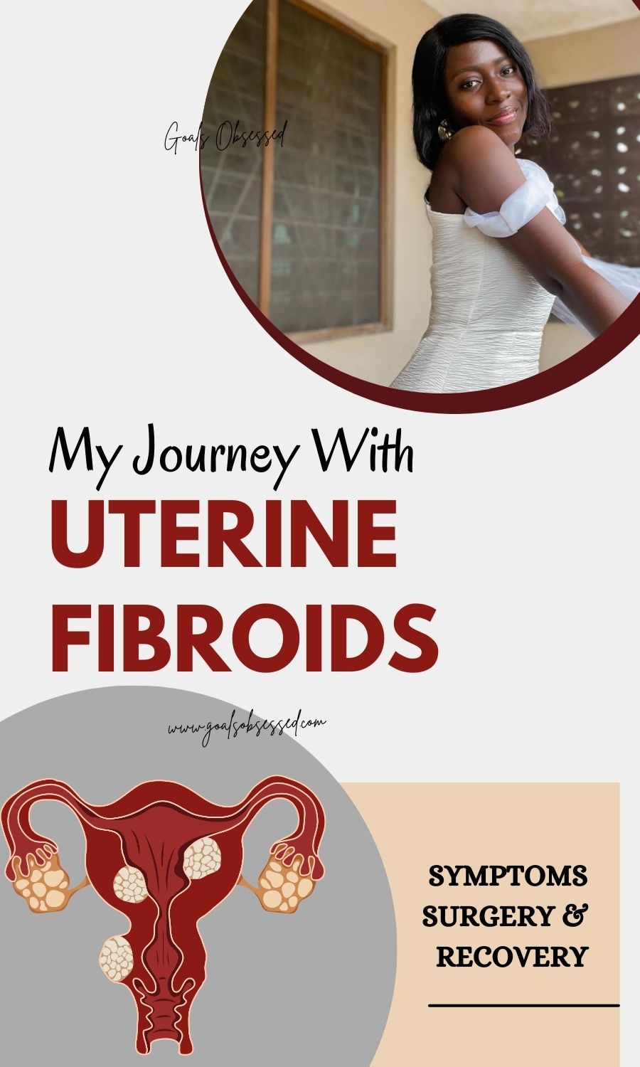 My journey with uterine fibroids